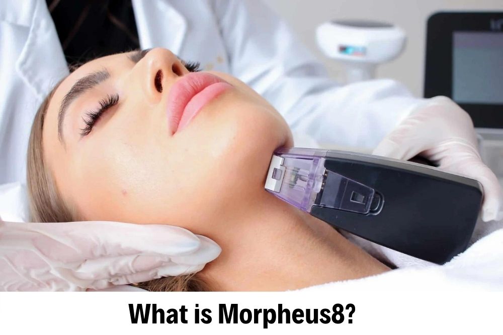 Morpheus 8